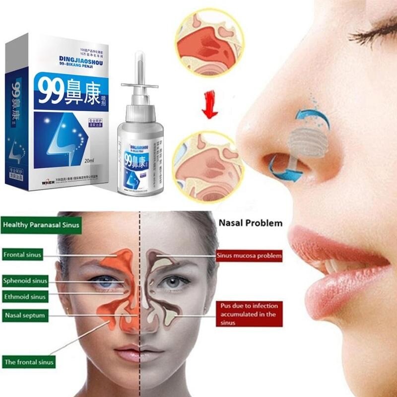 Jual Ori DINGJIAOSHOU HERBAL PELEGA HIDUNG TERSUMBAT Rhinitis Sinusitis ...