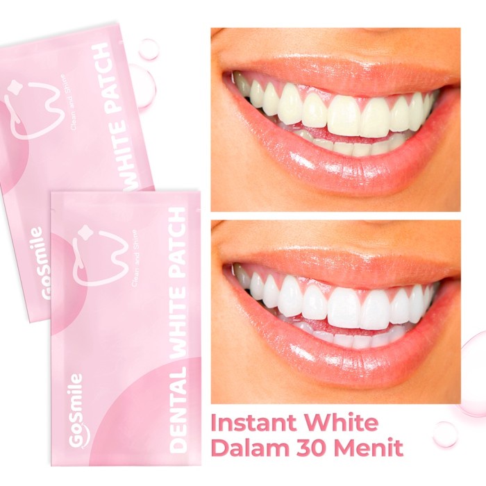 Jual GO SMILE DENTAL WHITE PATCH UNTUK GIGI SEPERTI BLEACHING