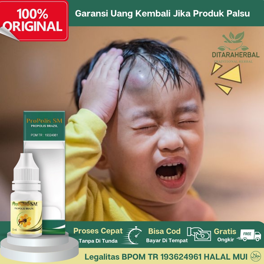 Jual Obat Penghilang Benjolan Di Dahi, Obat Dahi Jidat Bengkak, Obat ...