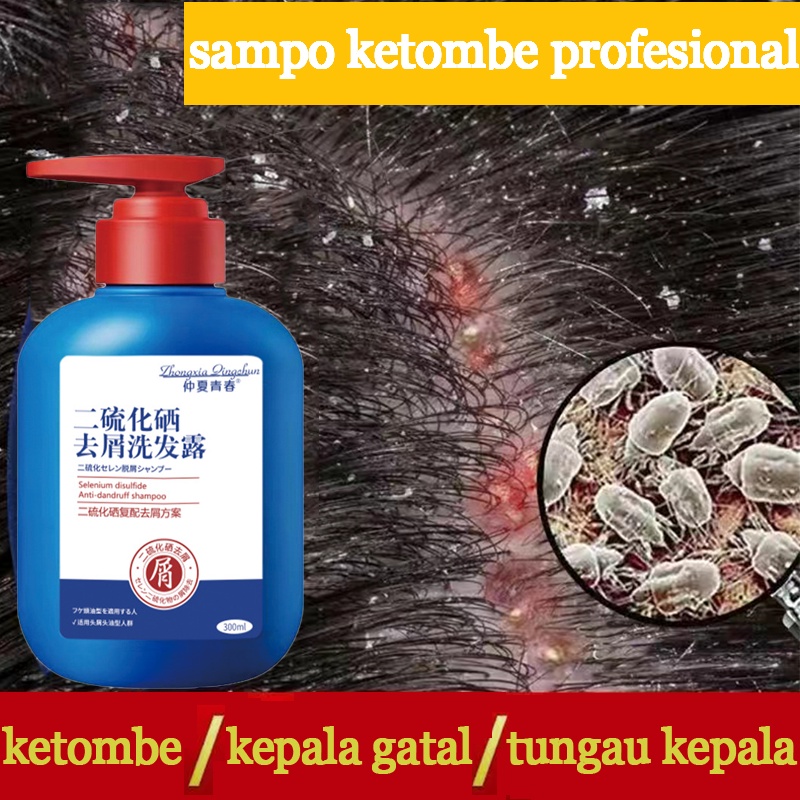 Perangi Ketombe dan Gatal: 12 Rekomendasi Shampoo untuk Kulit Kepala Sehat