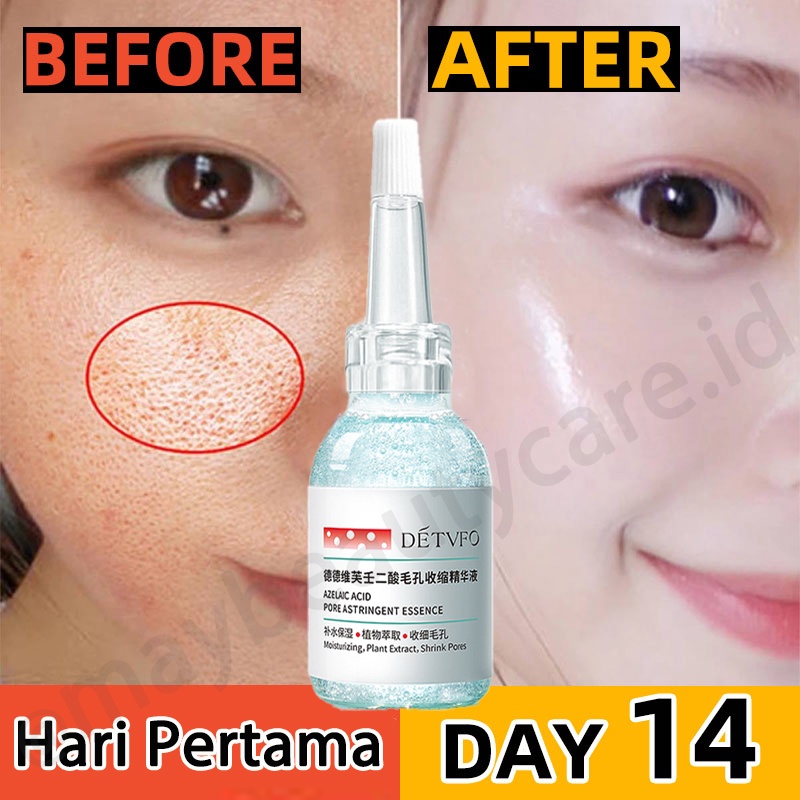 Jual Serum Pengecil Poripori Wajah Ampuh Mengontrol Minyak Wajah ...