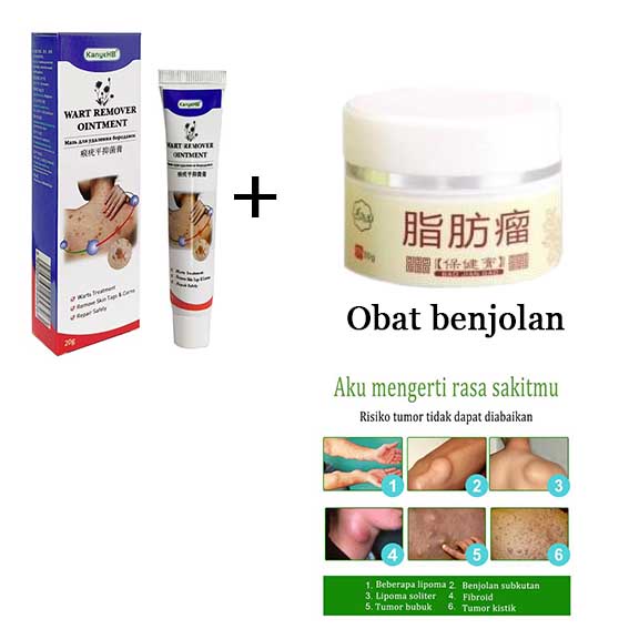 Jual Obat Kutil Obat Mata Ikan Wart Remover Penghilang Kutil G Remover Skin Tag Obat Kutil Di