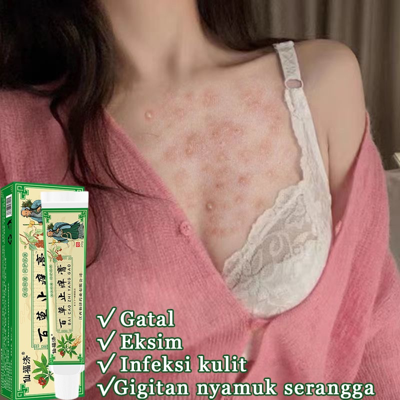 Jual Asli Salep Baicao Anti Pruritus Salep Anti Pruritus Gigitan Nyamuk Serangga