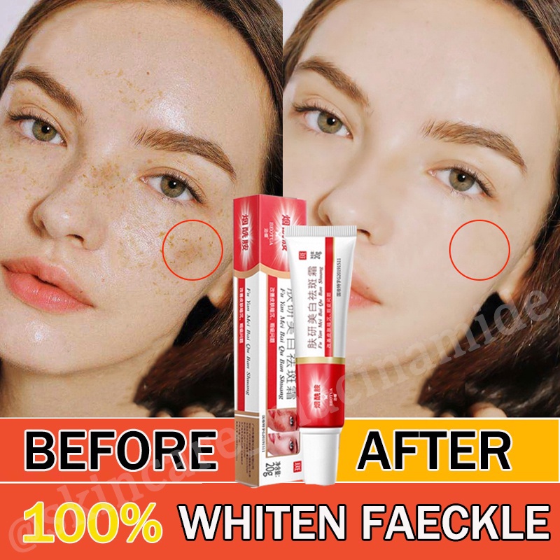 Jual Niacinamide Salep Flek Hitam Melasma Membandel 100 % ORIGINAL ...