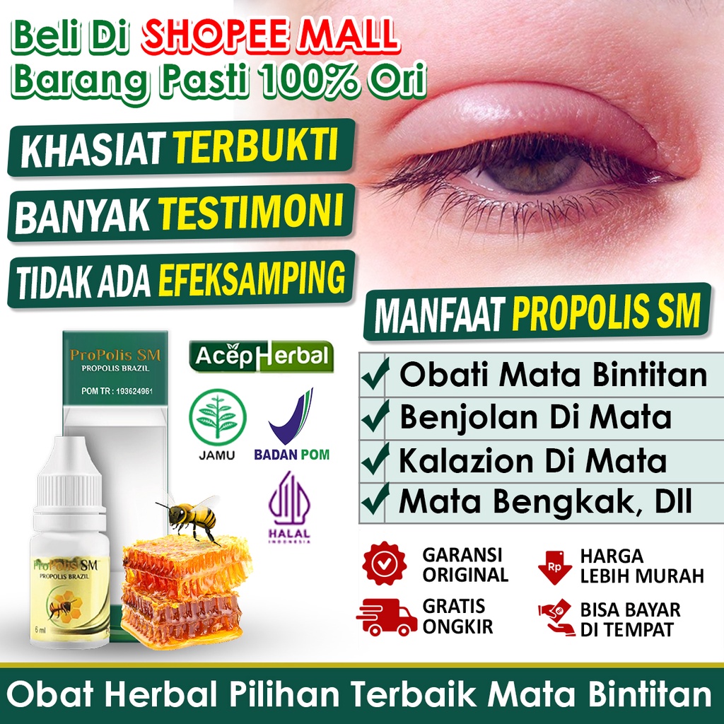 Jual Obat Mata Bintitan Mata Bengkak Manusia Pengempis Bengkak Di ...