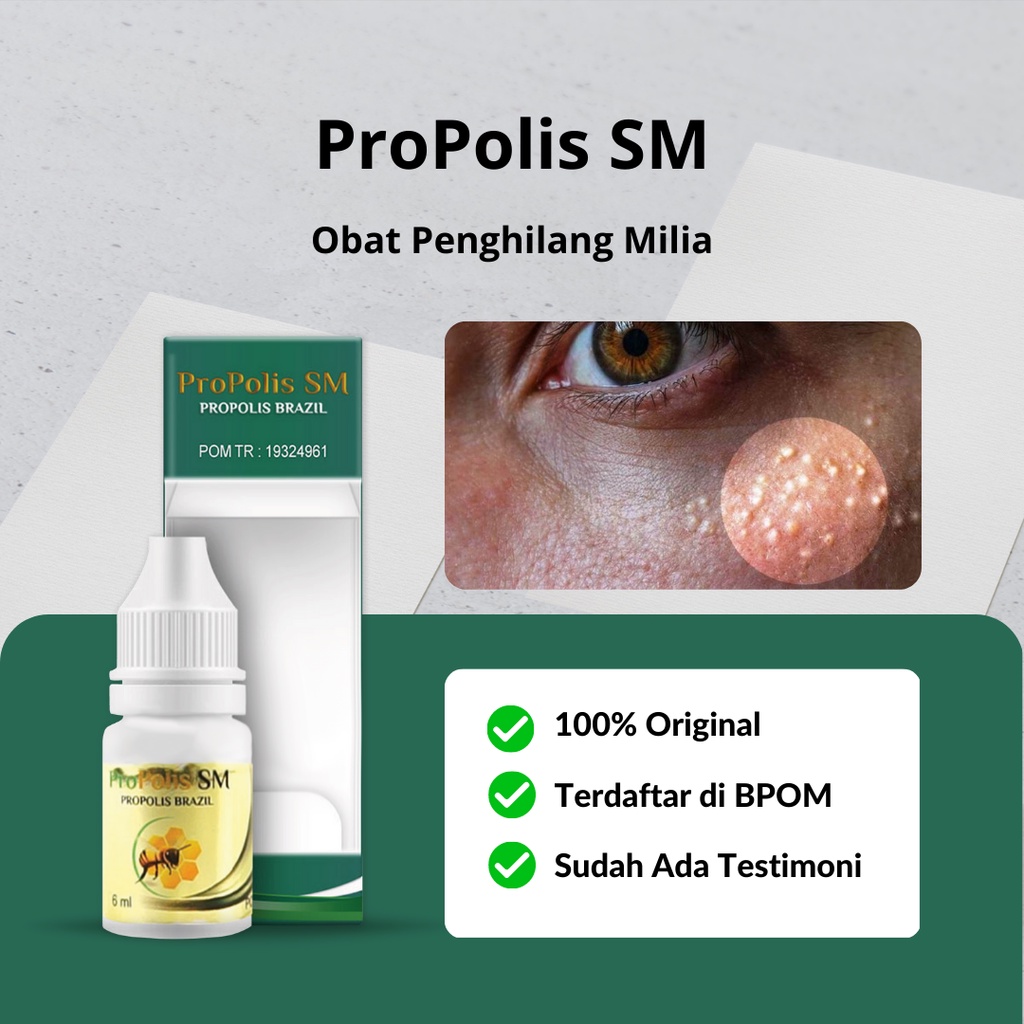 Jual Propolis Sm Obat Penghilang Milia Di Bawah Mata Bintik Putih