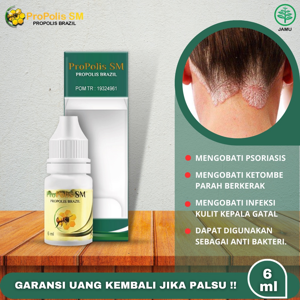 Bosan dengan Kulit Kepala Gatal dan Ketombe? 12 Resep Masker Alami yang Terbukti Efektif!