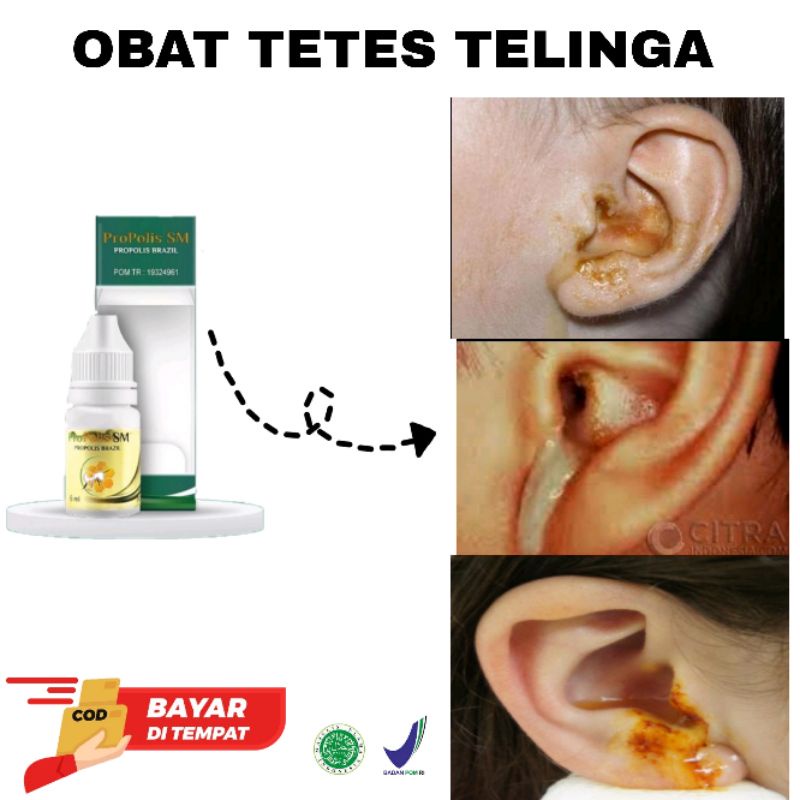 Jual Obat Tetes Telinga Berair Bernanah Bau Busuk Telinga Congek 15ml