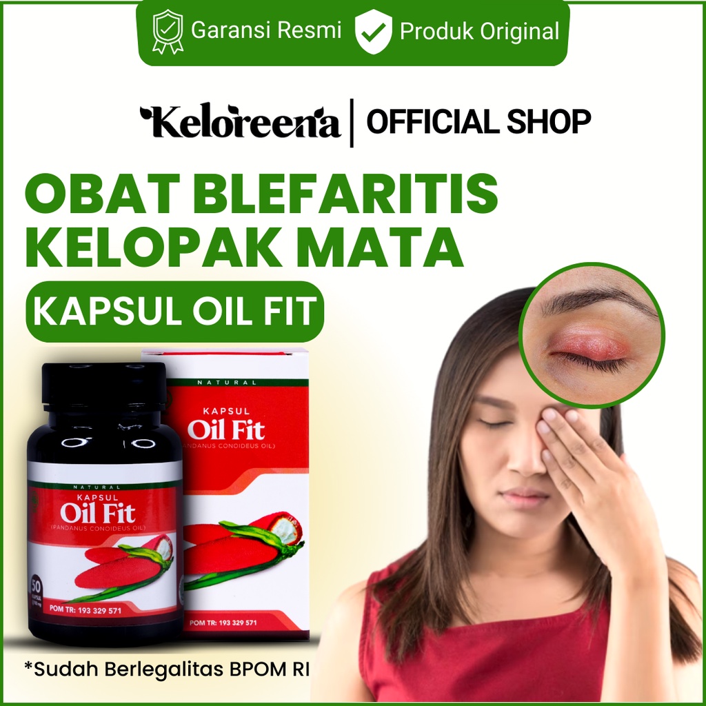 Jual Obat Blefaritis Radang di Kelopak Mata Merah Iritasi Perih Gatal