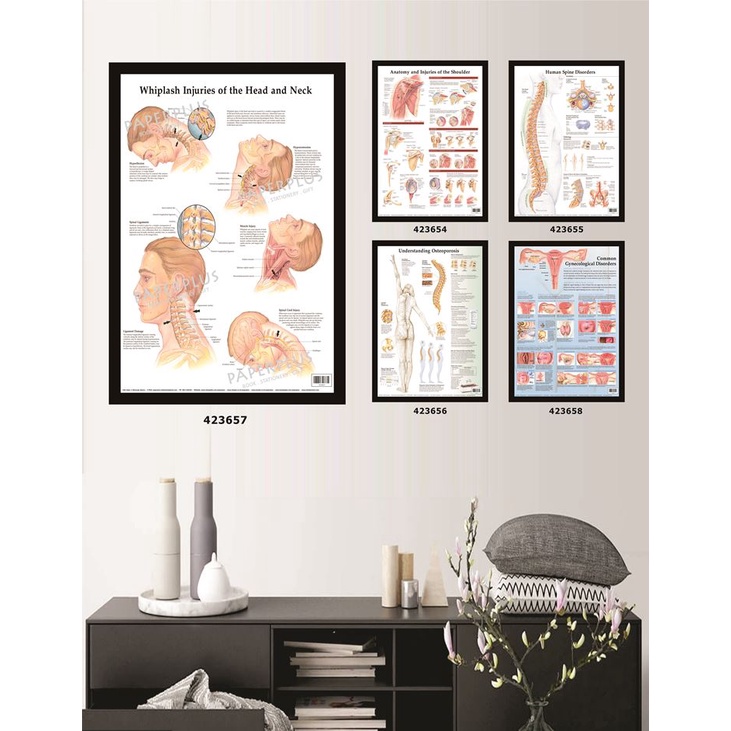Jual Poster Kedokteran / Kesehatan / Whiplash Injuries Of The Head And ...