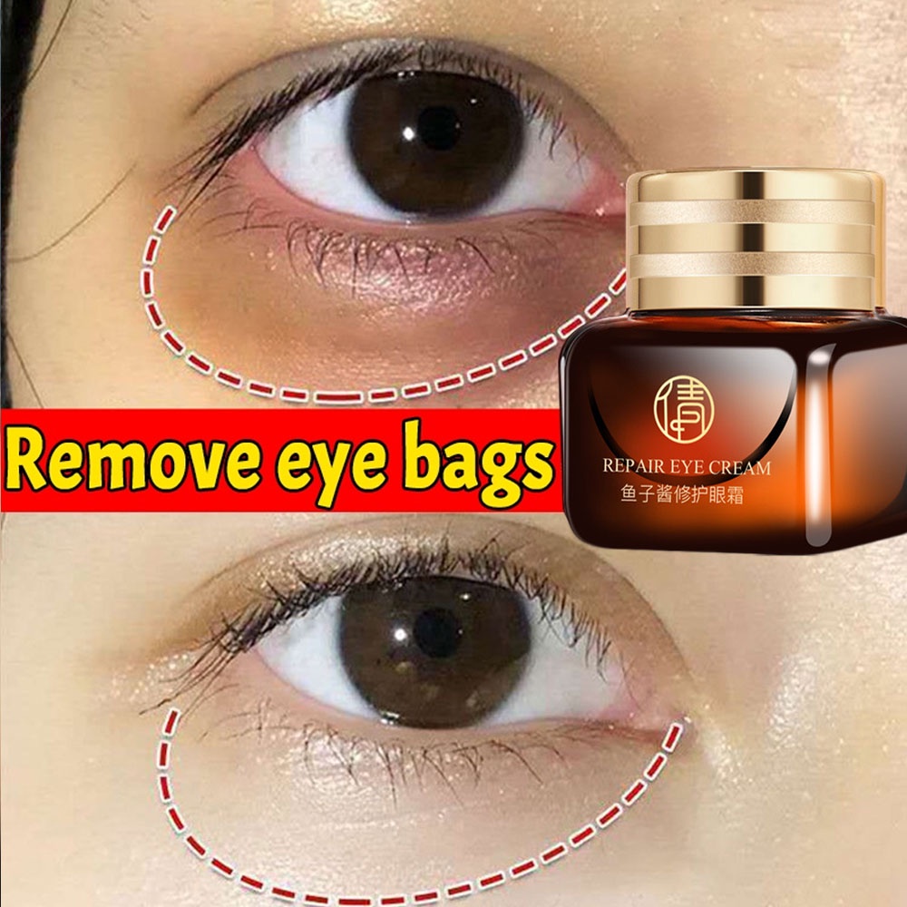 Jual Eye cream menghilangkan milia menghilangkan keriput di mata dan