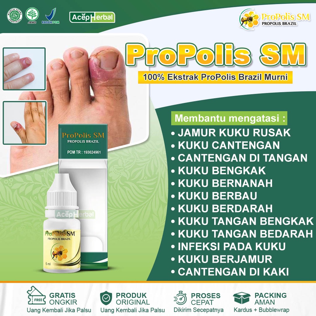 Jual Obat Cantengan Jempol Kaki Dan Tangan Jamur Kuku Rusak Bengkak