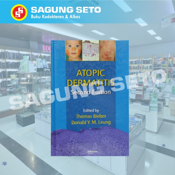 Jual Must Have!! Atopic Dermatitis 2E - Thomas Bieber / Dermatologi ...