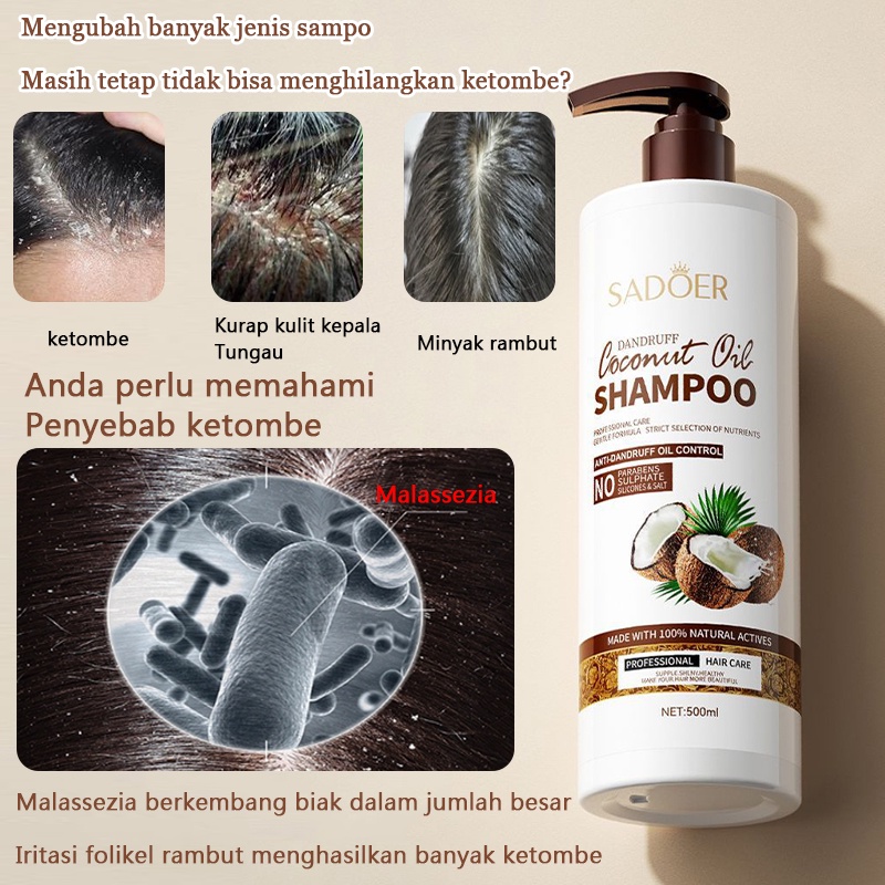 Jual Sampo anti ketombe Sampo ketombe Shampo kutu rambut 500ML Asam ...