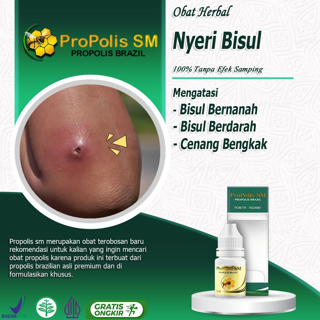 Jual Obat Propolis Sm Mengatasi Bisul Bisul Di Pantat Di Punggung