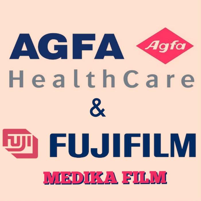 Jual Best Seller Film Ronsen Rontgen Dry/Digital Agfa Drystar Dt5B Size ...
