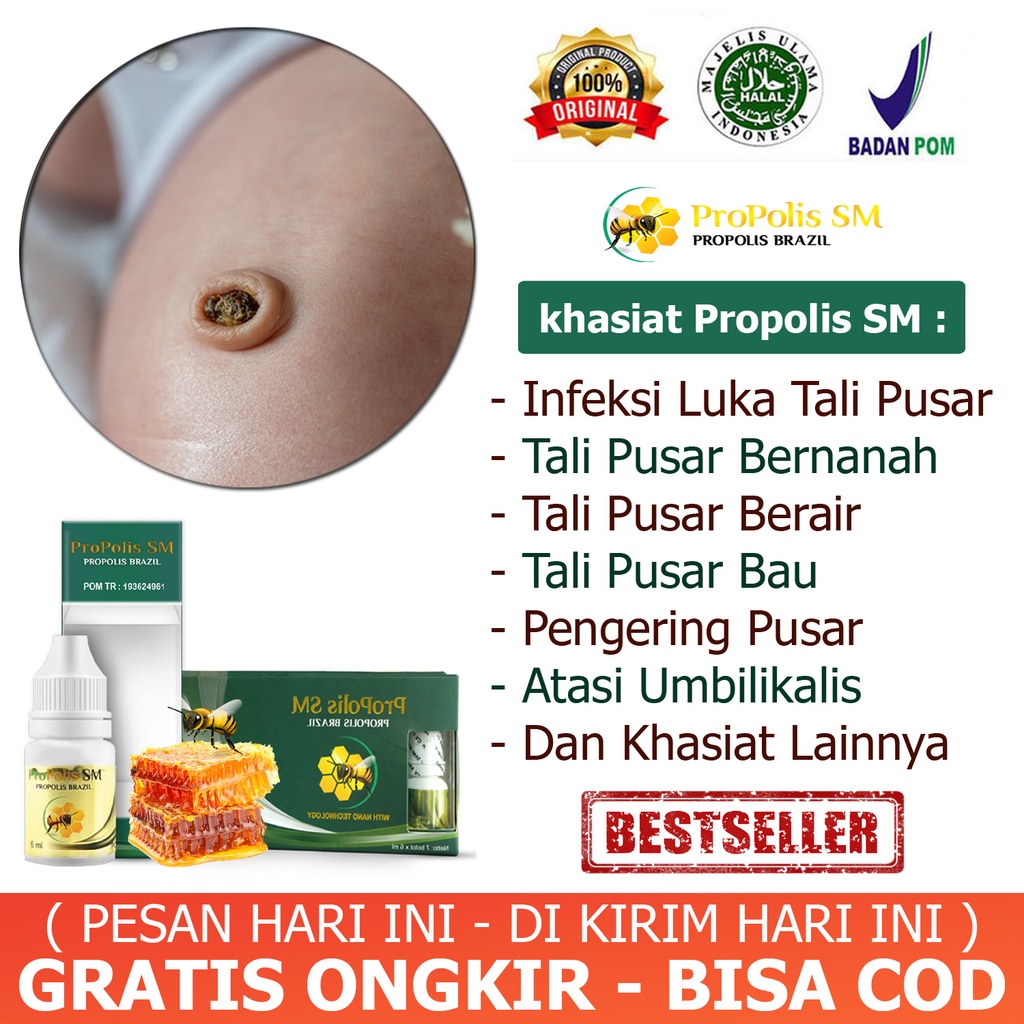 Jual Obat Infeksi Luka Tali Pusar Bayi Tali Pusar Bayi Bernanah Dan