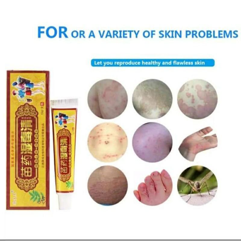 Jual Salep Obat Gatal Gatel Jamur Eksim Anti Bakteri Psoriasis