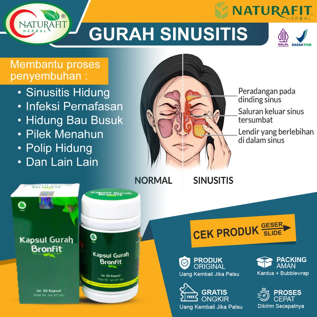 Jual Obat Sinusitis Paling Ampuh Pilek Menahun Hidung Bau Busuk Infeksi ...