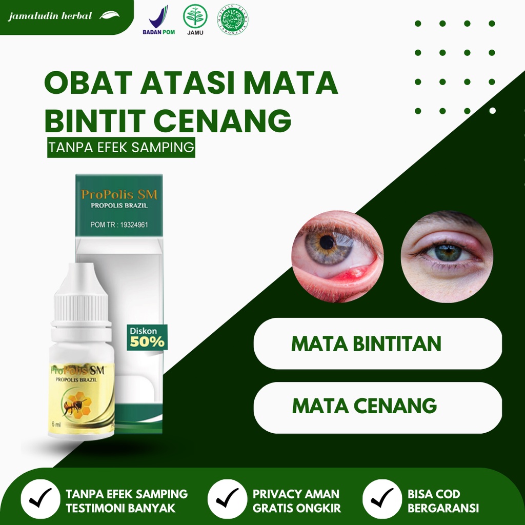 Jual Obat Oles Pengempis Benjolan Di Kelopak Mata Bintitan Dan Bintilan Kalazion Propolis Sm