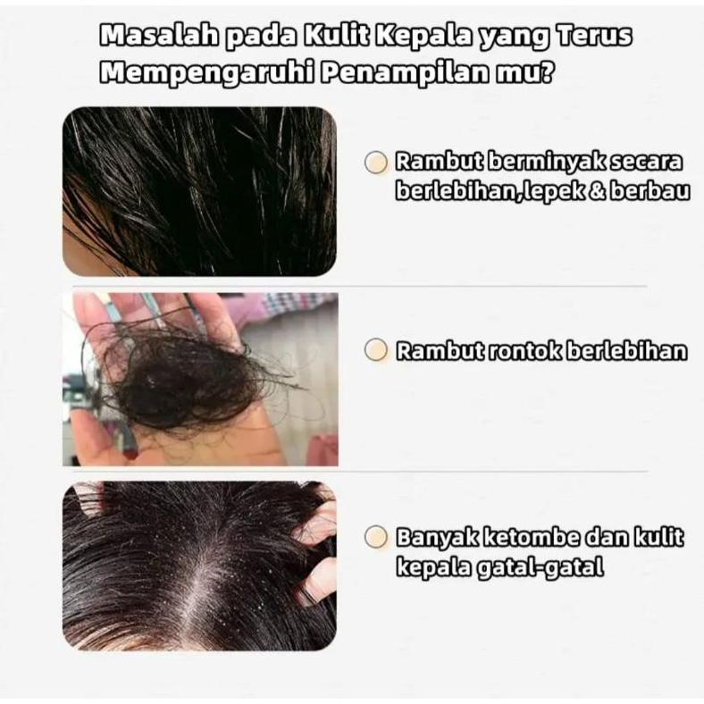 Jual Terjangkau Remimpi Anti Hair Fall Hair Treatment Shampoo Oil Control Anti Dandruff Anti 7368