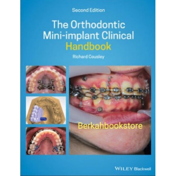 Jual The Orthodontic Mini-implant Clinical Handbook 2nd Edition Richard ...