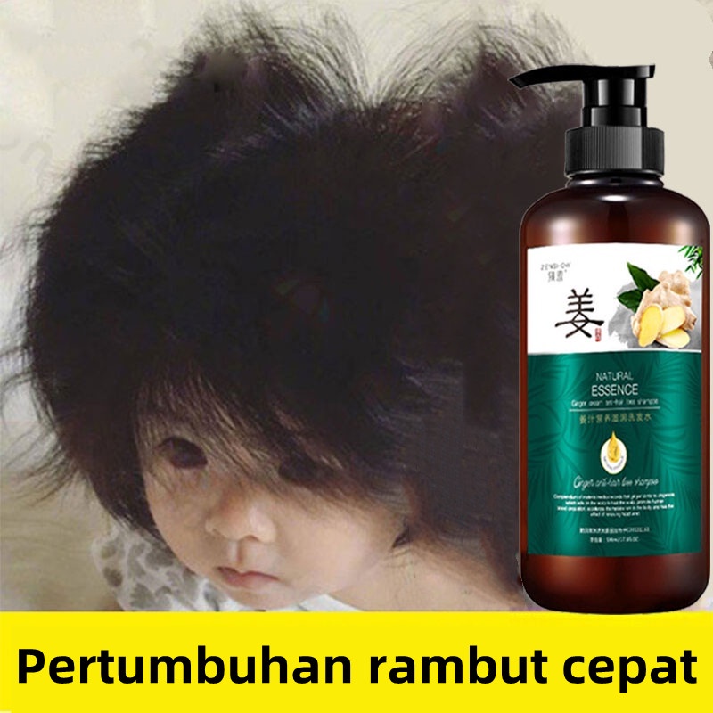 Jual Sampo Penumbuh Rambut Cepat Sampo Anti Ketombe Shampo Rambut ...