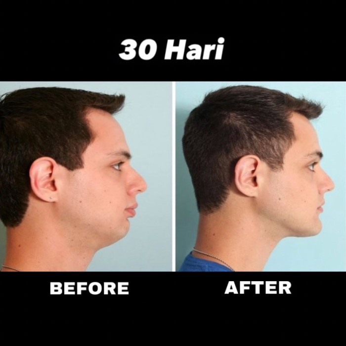 Jual Jawline Me Excercise Rubber Latihan Otot Rahang Jawliner Fitness