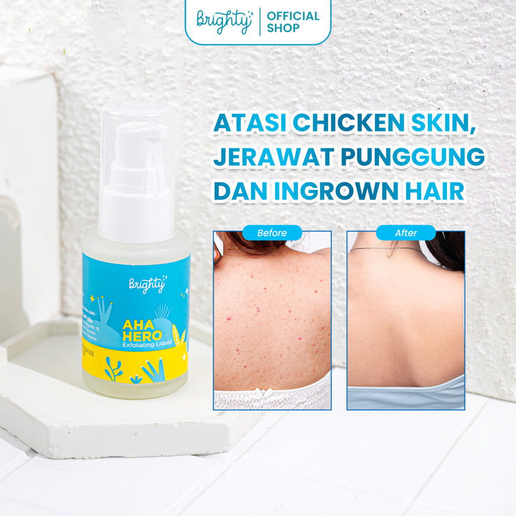 Jual Brighty Aha Hero Exfoliating Liquid Serum Pencerah Ketiak ...