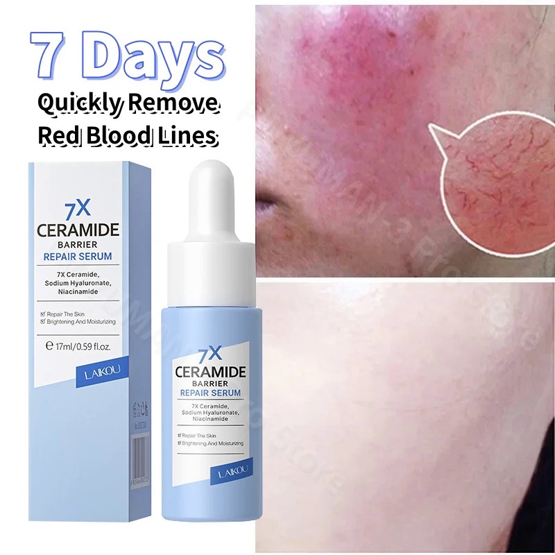Jual 7X Facial Redness Soothing Serum Instant Rosacea Red Blood Vein