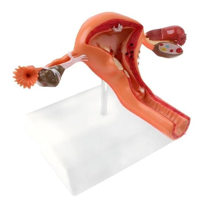 Jual Model Rahim Uterus Ovary Anatomical Patologis Uterus Ovarium ...