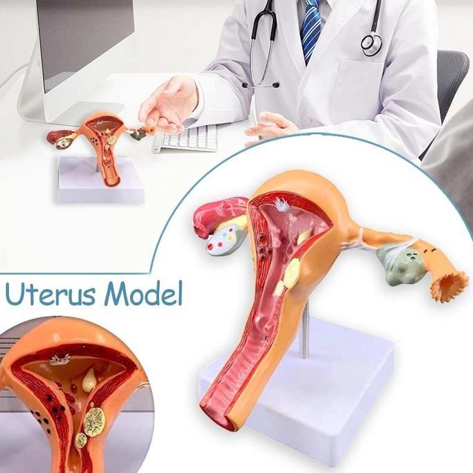 Jual Model Rahim Uterus Ovary Anatomical Patologis Uterus Ovarium ...