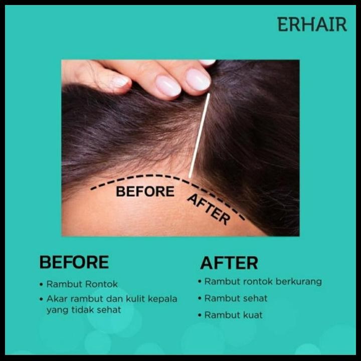 Jual Terlaris Erhair Erha Hairgrow Hair Grow Tonic 60Ml 60 Ml Penumbuh ...