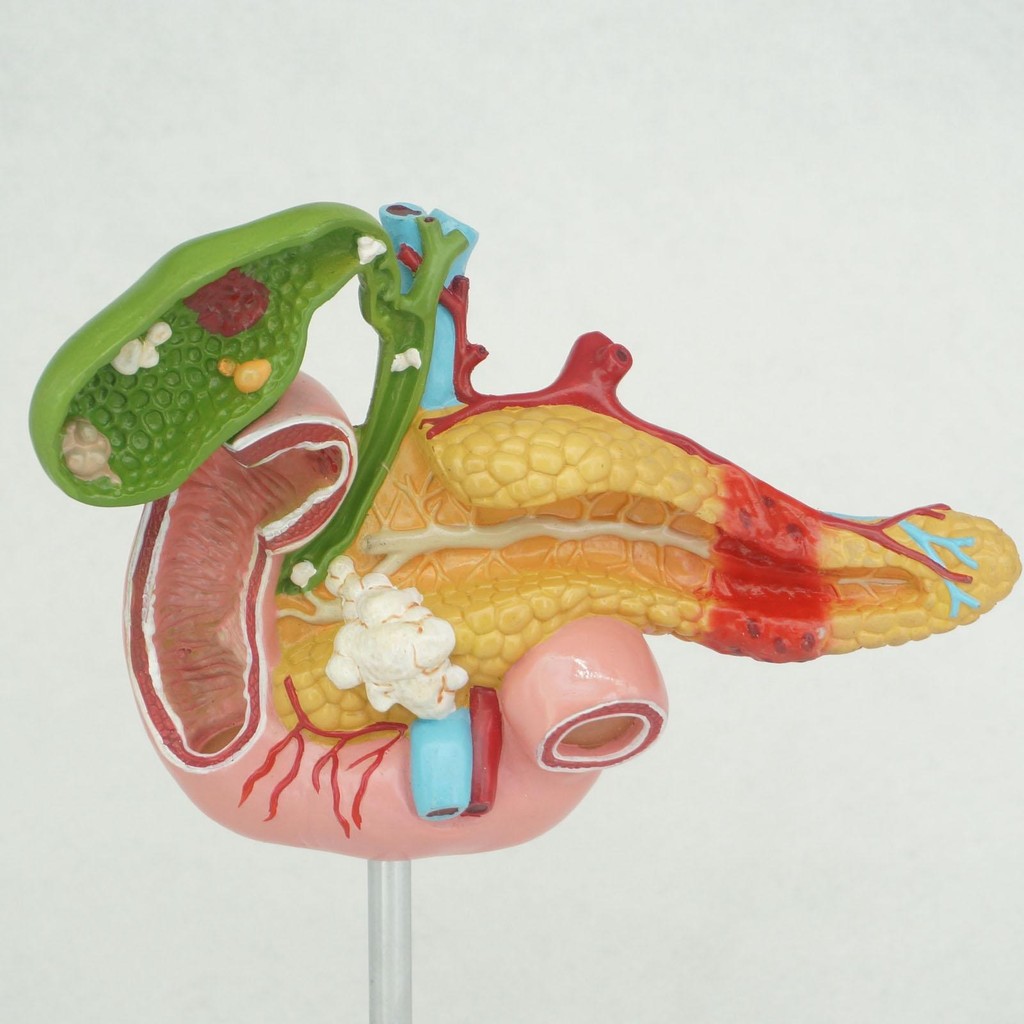 Jual Human Anatomical Duodenum Gall Bladder Disease Anatomy Medical ...