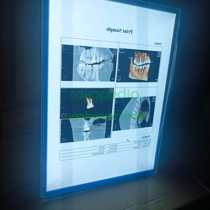 Jual Lampu baca Rontgen ronsen viewer LED portable 249x340mm uk.A4 ...