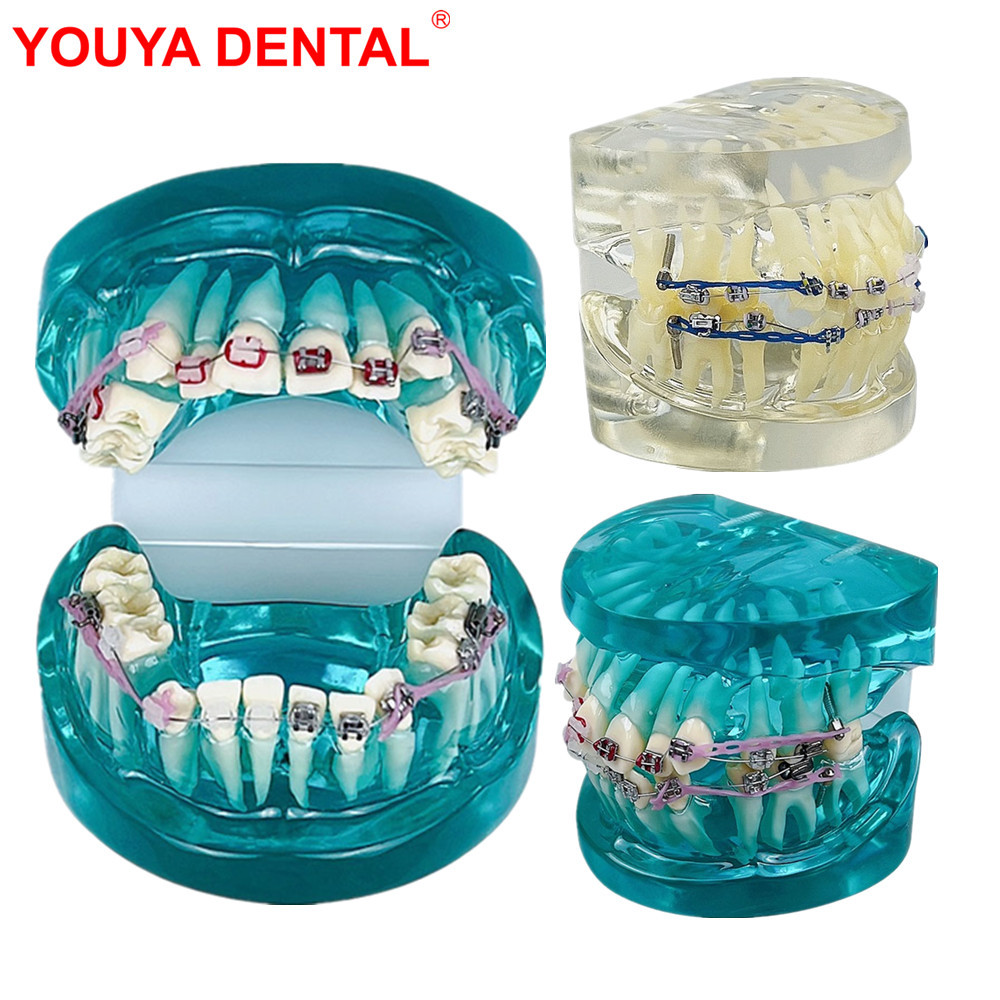 Jual Al Mubarokk New Dental Orthodontic Treatment Model Standard ...