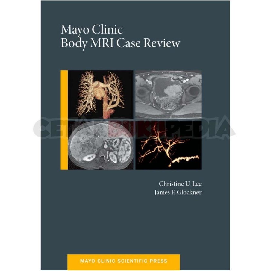 Jual Mayo Clinic Body Mri Case Review 2014Christine Lee Softcover ...