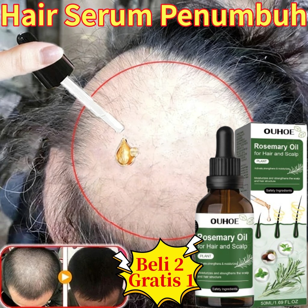 Jual Mooncy Hair Serum Penumbuh Rambut Cepat Dan Tebal Rosemary Oil ...