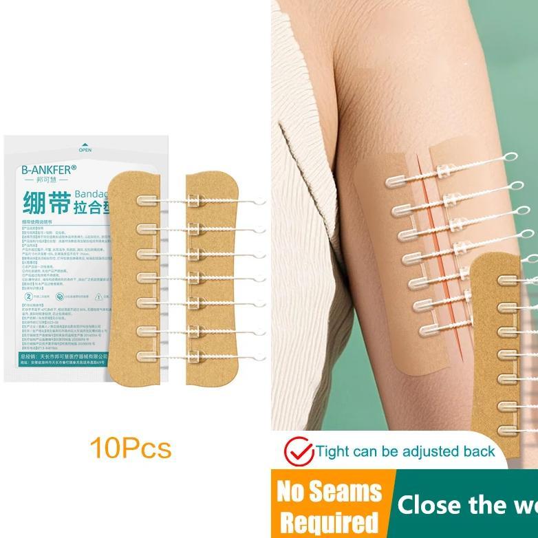 Jual Zipper Tie Wound Closure Patch Hemostatic Patch Wound Fast Without ...
