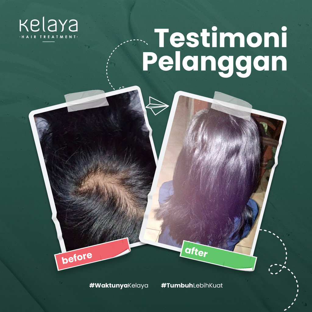 Jual Kelaya Protein Power Hair Essence 100ml Hair Tonic Vitamin ...