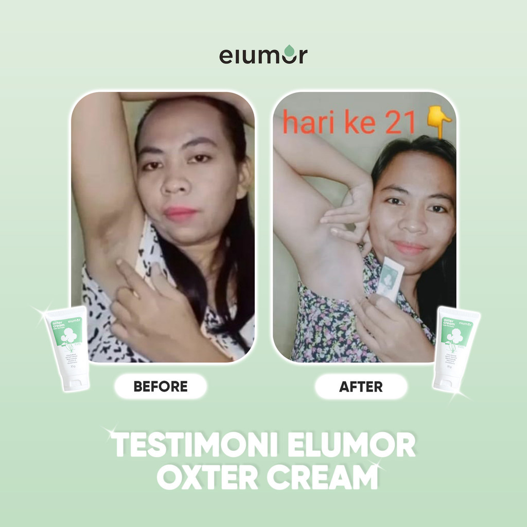 Jual 2Elumor Oxter Cream New Formula 30gr Krim Pemutih Ketiak Dan ...