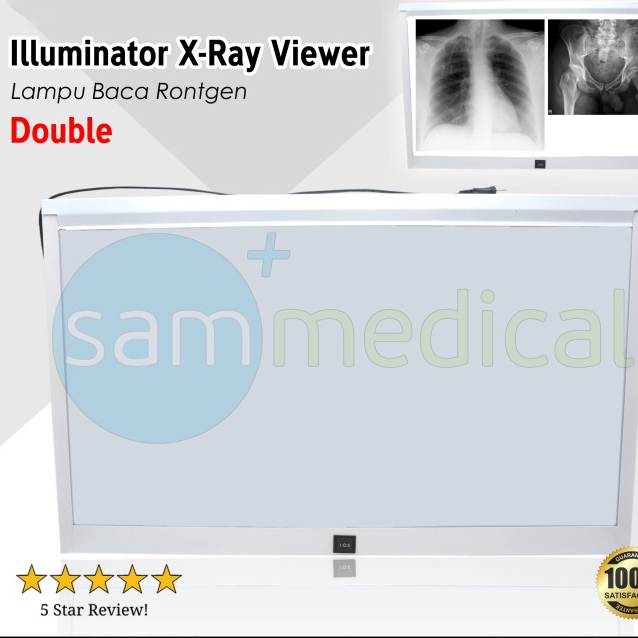 Jual Lokal Illuminator XRay Viewer / Lampu Baca Rontgen Double