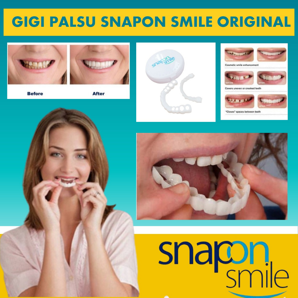 Jual Gigi Palsu Instan 1 Set Atas Bawah Snap On Smile 100% Original ...