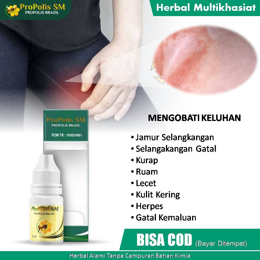 Jual Obat Jamur Selangkangan, Selangkangan Gatal dan Bersisik, Kurap