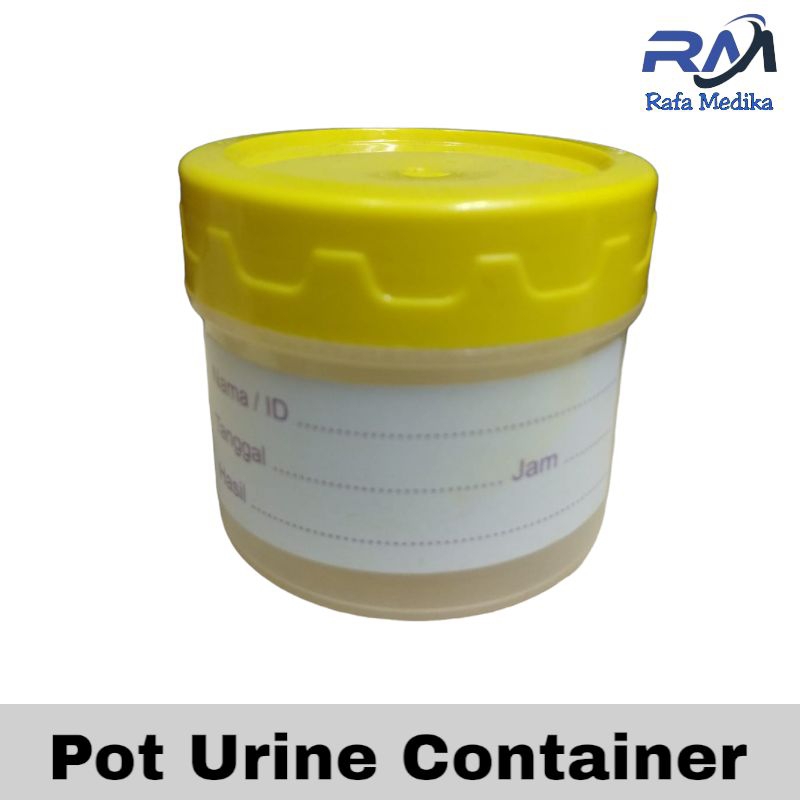 Jual Sample Container Pot Urine Pot Urin | Shopee Indonesia