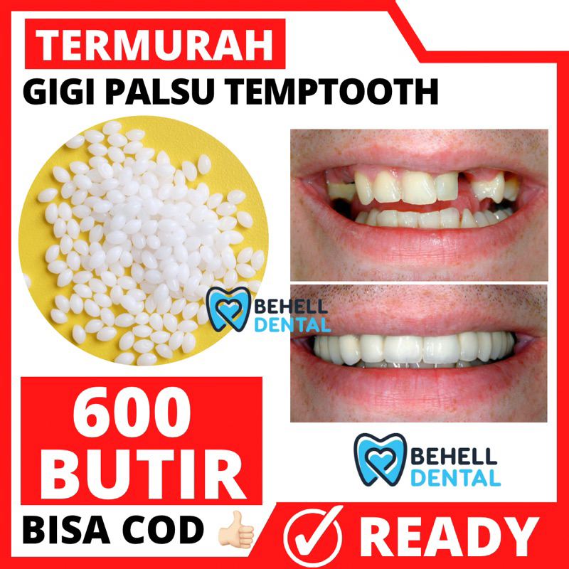Jual 1000 BUTIR Temptooth Temp Tooth Lem Gigi Palsu Bahan Tambal