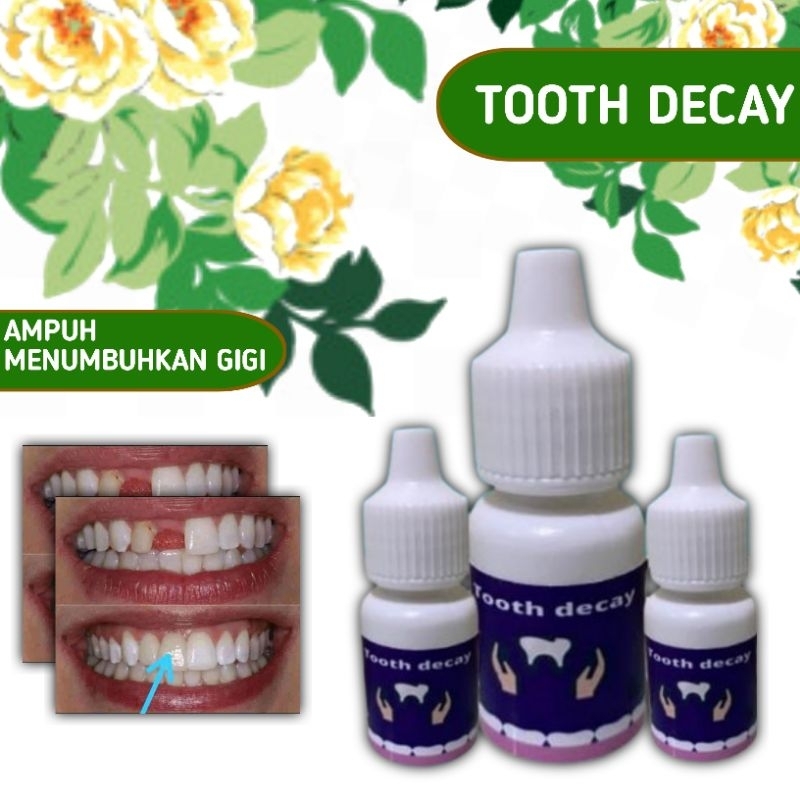 Jual TOOTH DECAY ( PENUMBUH GIGI, OMPONG, KROPOS, BERLUBANG, PATAH