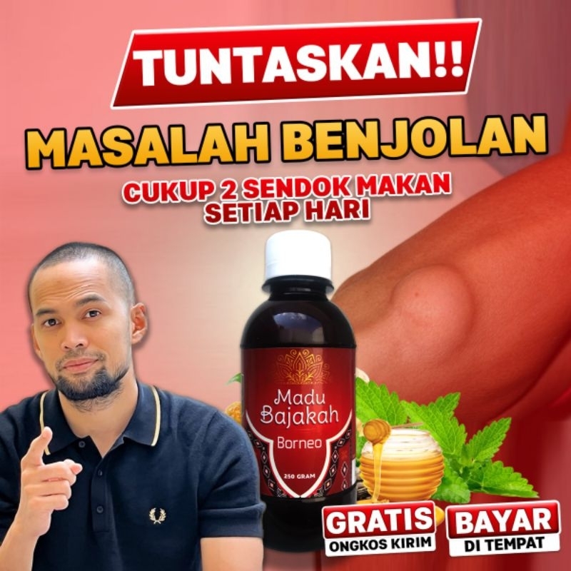 Madu Bajakah Borneo Asli Atasi Benjolan tumor kelenjar kanker