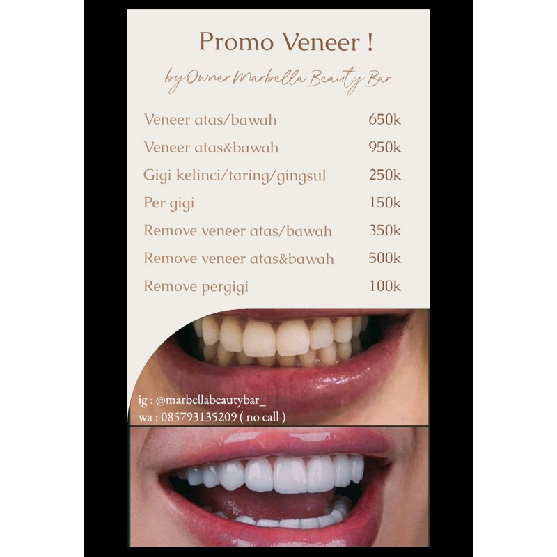 Jual veneer gigi by owner marbella beauty bar Shopee Indonesia