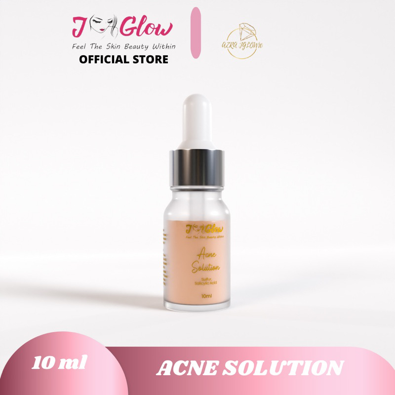 Jual JGLOW ACNE lotion sulfur obat jerawat / buat jerawat yang meradang